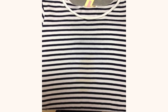 Before画像1